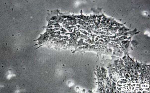 据美国科学家称,他们发现人体内使人变笨的藻类病毒！