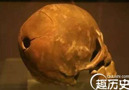古代人头骨上的孔是哪里来的？吸食人脑所致？
