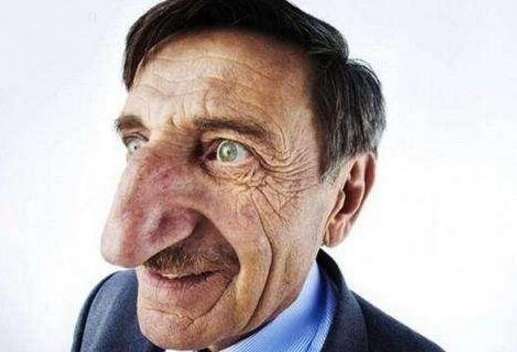 世界上最大鼻子的人，土耳其一男子鼻长8.8厘米