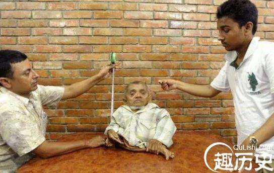 英国最矮父亲 50岁身高仅88公分，他的脚就像一岁儿童的脚