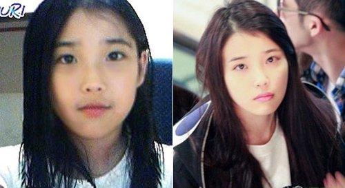 iu李智恩承认整容 iu李智恩减肥前后照片对比