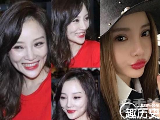 女星整容后遗症笑起来吓死人 巩新亮李小璐郑爽