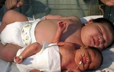 世界十大巨婴排行 山东产妇产下12.9斤巨婴