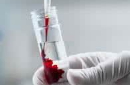 基因编辑技术成功治疗实验鼠血友病