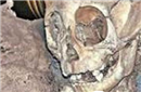 古墓惊现畸形头骨 考察结果惊人疑似外星人？