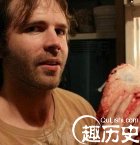 男子食用生肉和新鲜血液 身体的变化惊呆所有人