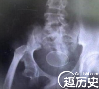 QQ截图20160113133720.png