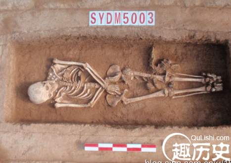 死后分娩