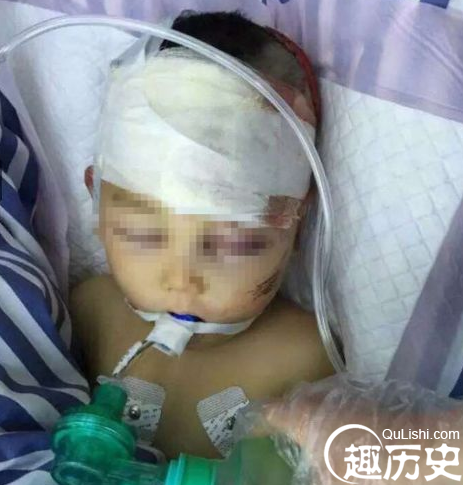 男童摘错菜被继父砸死 