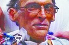 惊呆了！美国男子成全球首名“无心人”