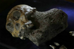 南非发现最古老癌症患者 为骨肉瘤距今170万年