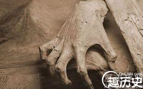 古代尸体疗法