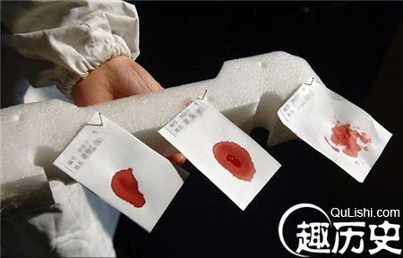  “滴血认亲”