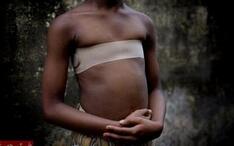 揭秘非洲可怕陋习：竟用热石头烫少女的胸部