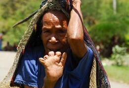 奇特风俗!亲人死了这里的女人要切掉自己的手指