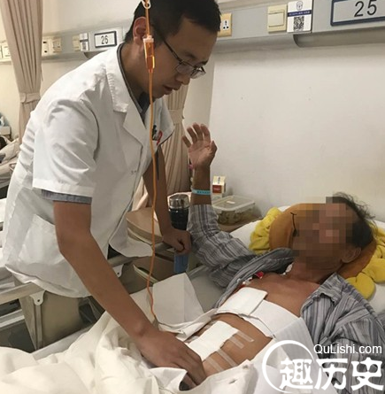男子腹腔出血1500毫升 “肇事者”竟是一条大鱼