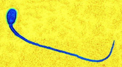 blob.png